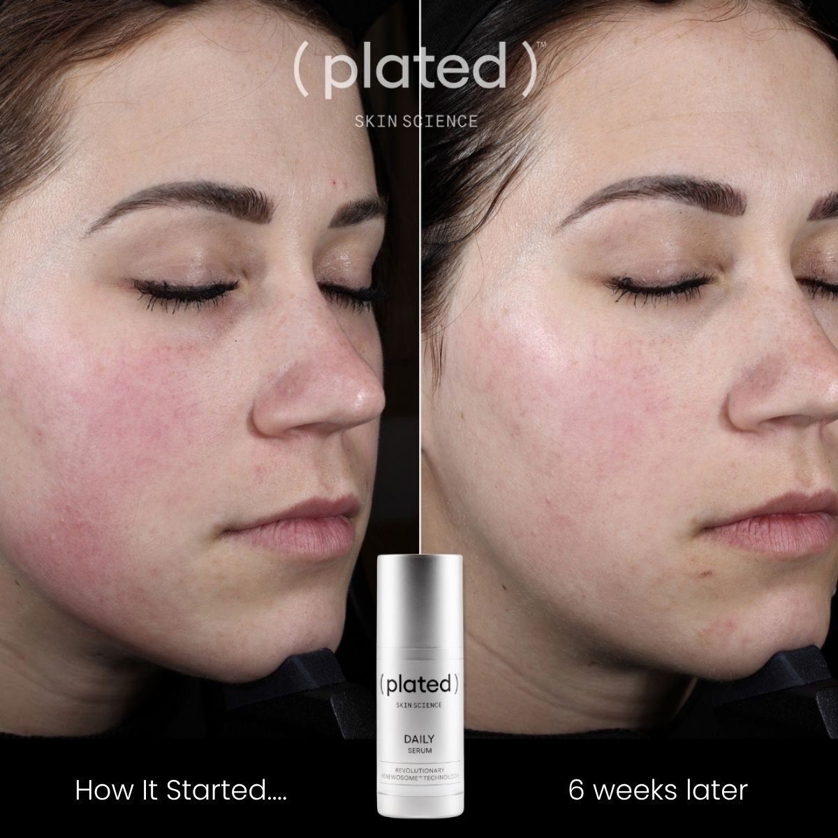 (plated) Daily Serum