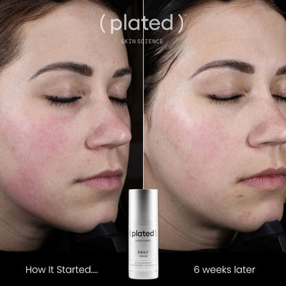 (plated) Daily Serum