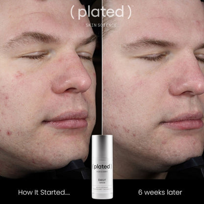 (plated) Daily Serum