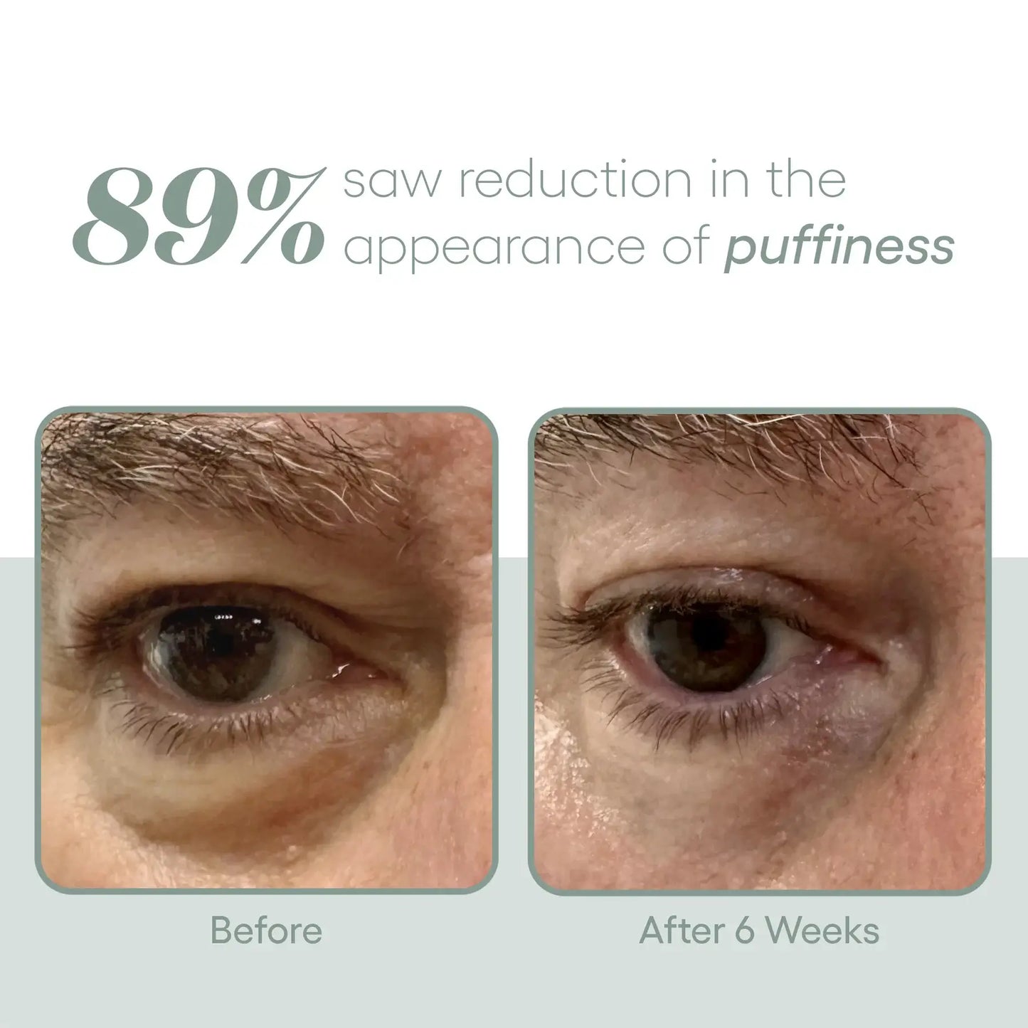 (plated) Eye Serum