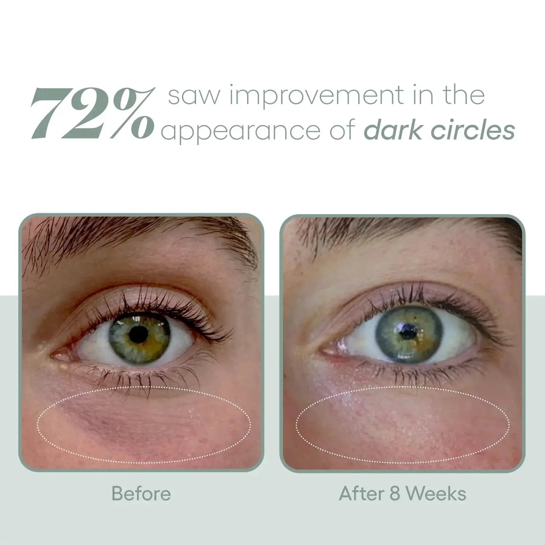EYE Serum - Filler Lux
