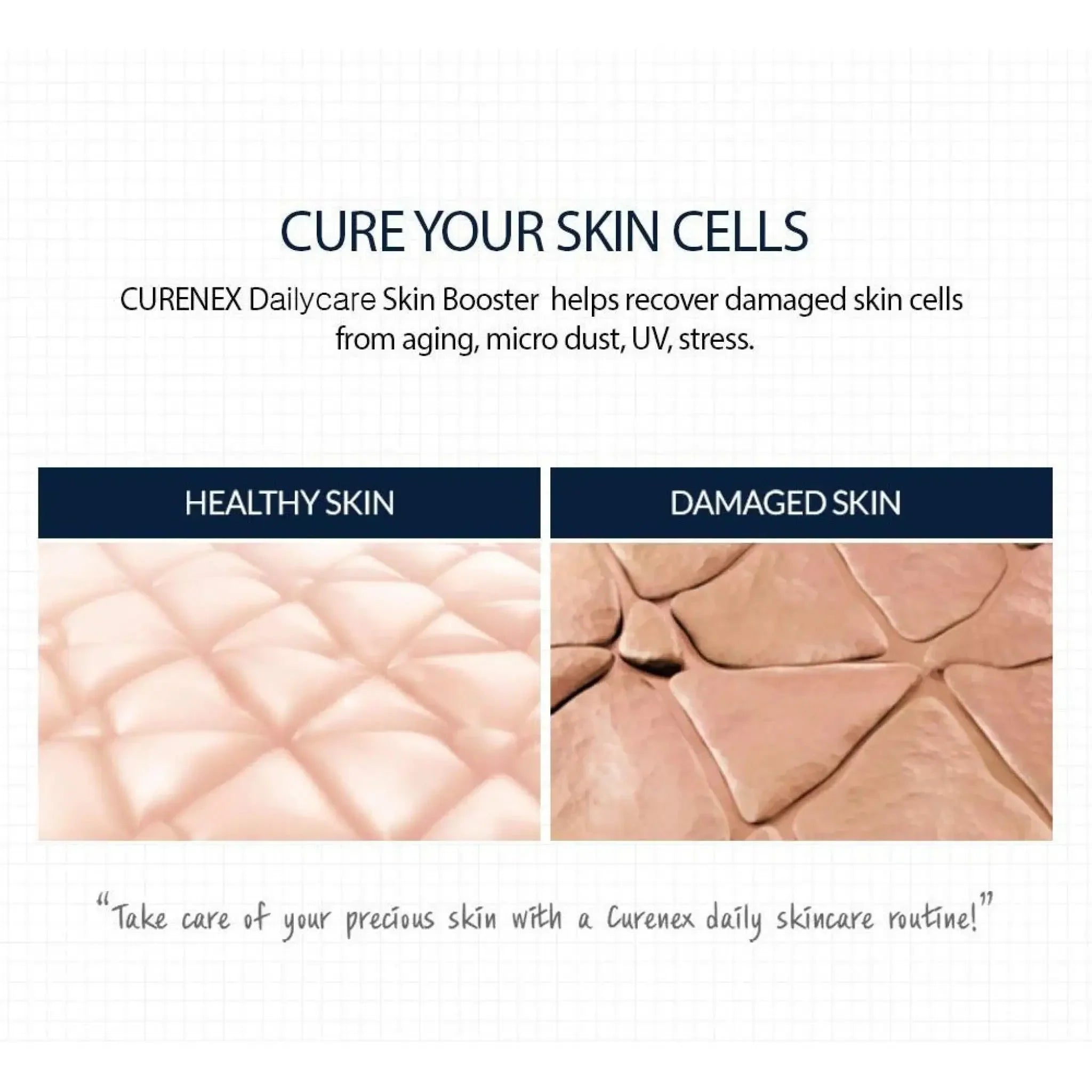 Curenex Dailycare Skinbooster - Filler Lux