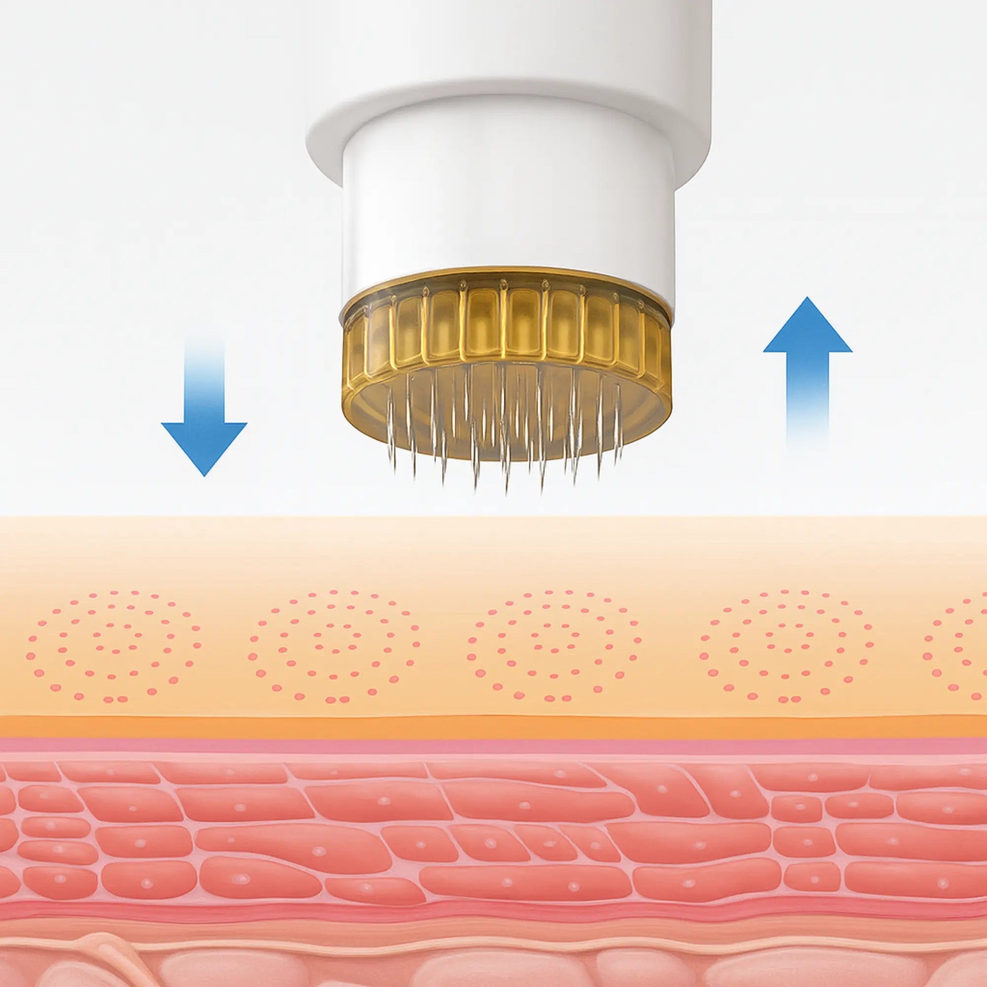 Dr. Stamp Microneedle Treatment DRS 40 - Filler Lux