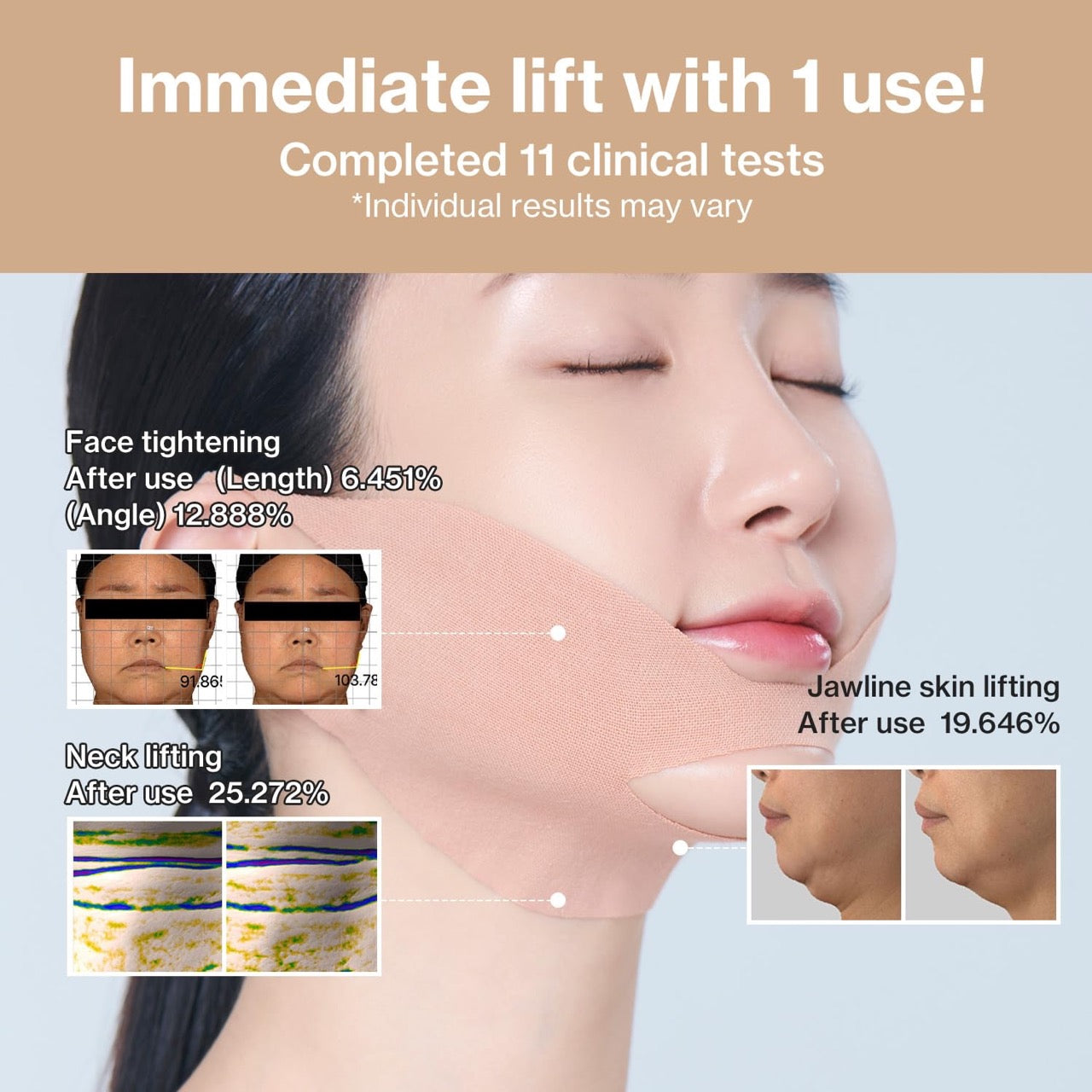Face Fit Minus Band V3 - id PLACOSMETICS - Mesoglow